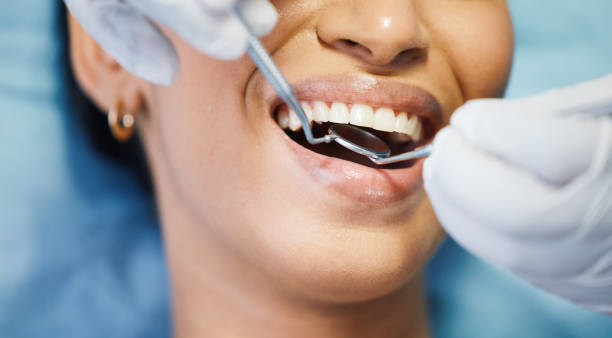 Best Cosmetic Emergency Dentistry in Keuka Park, NY