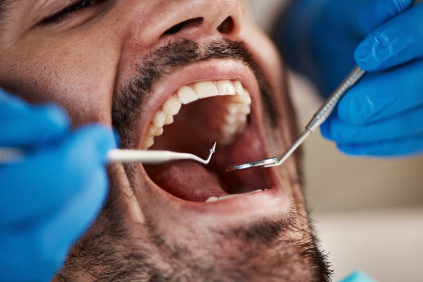 Best Emergency Denture Repair in Keuka Park, NY
