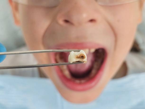 Best Pediatric Emergency Dentist in Keuka Park, NY