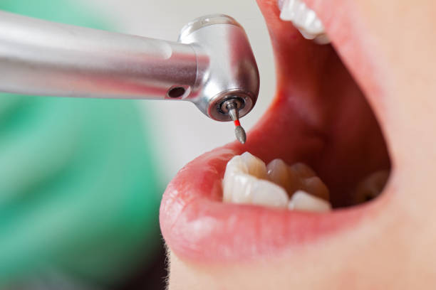 Best Cosmetic Emergency Dentistry in Keuka Park, NY